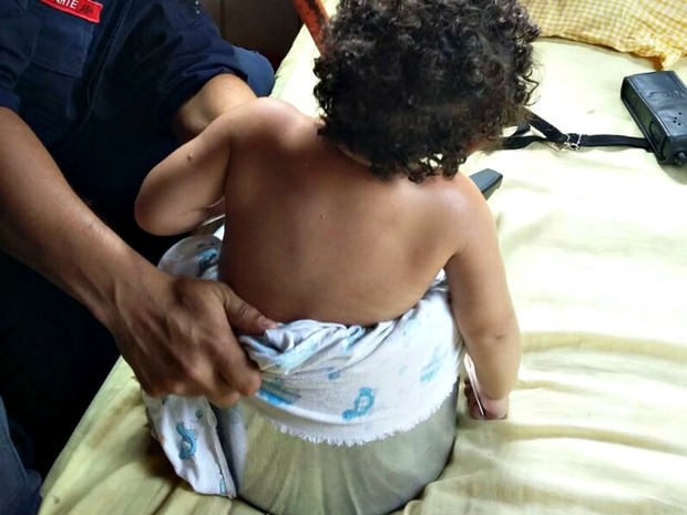 Menina de um ano e oito meses ficou presa � panela de press�o  (Foto: Divulga��o/Bombeiros)